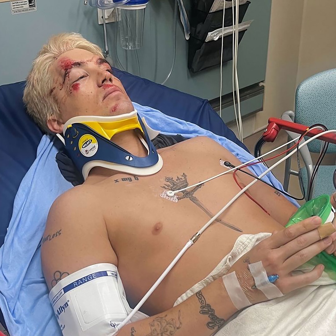 LANY Singer Paul Klein Hospitalized After Being Hit by Car LANY Singer Paul Klein Hospitalized After Being Hit by Car